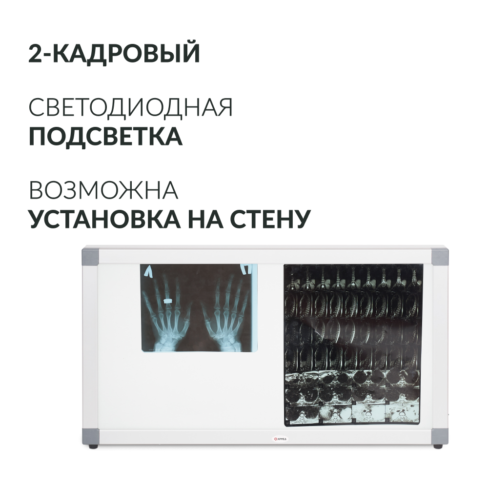 Негатоскоп общего назначения Армед 2-кадровый 